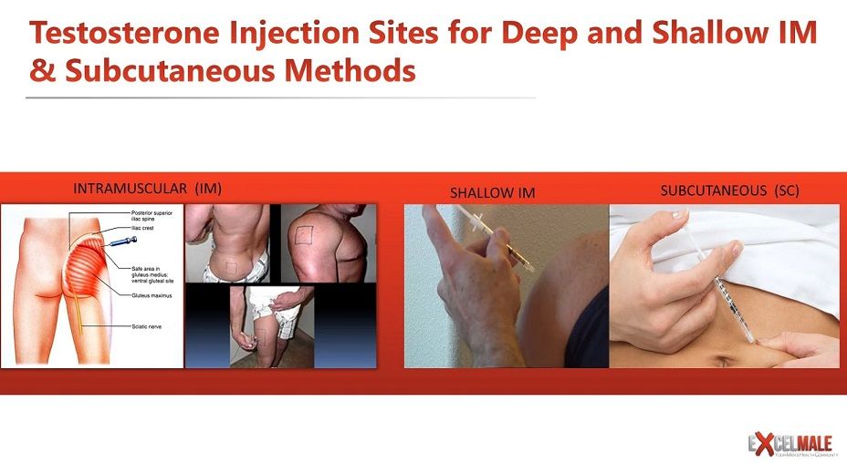 where to inject testosterone subcutaneous versus intramuscular